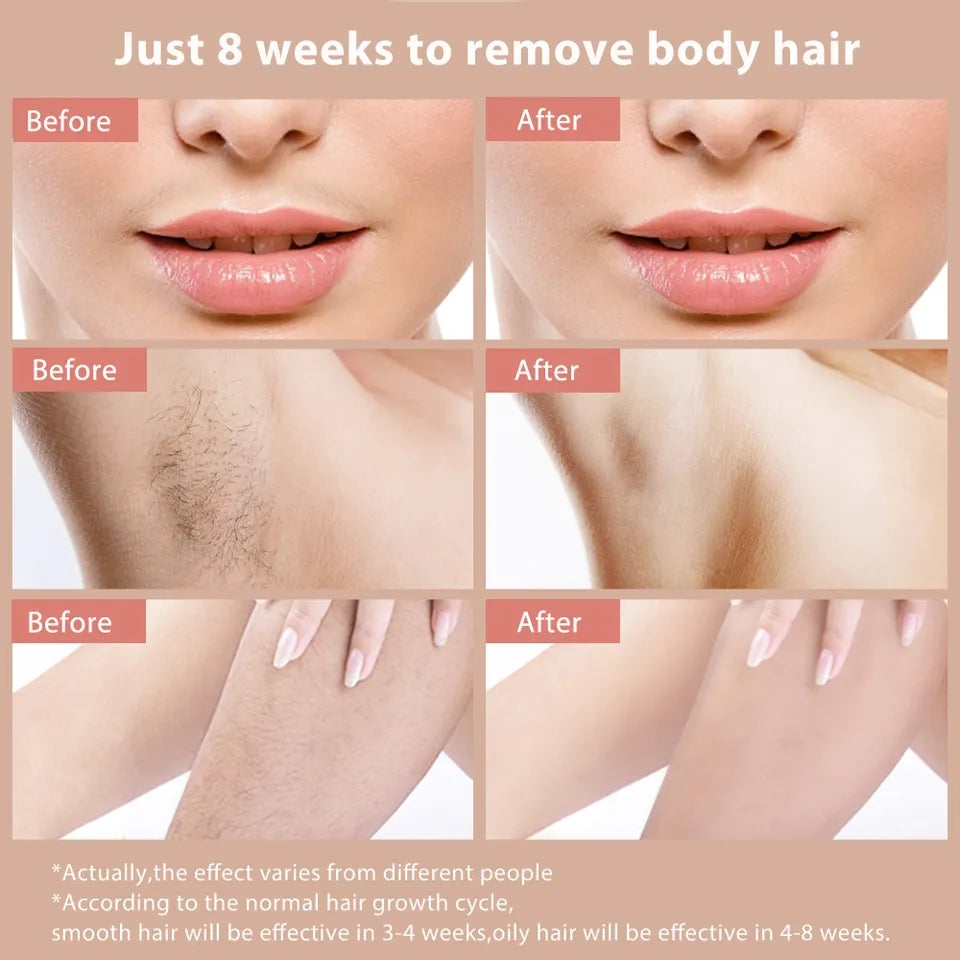 Professional IPL Laser Epilator Hair Removal for Full Body Women Legs Bikini Painless Hair Remover Permanent Ice Freezing Device